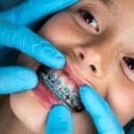 4 Care Tips For Children With Braces - LeBlanc & Associates Dentistry For Children in Kansas